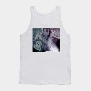 Flexion of the cervical spine, X-rays (C048/0639) Tank Top